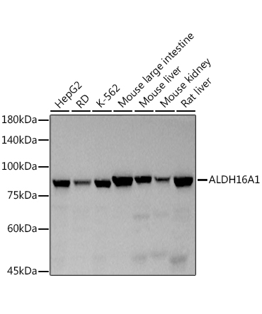 ALDH16A1 Rabbit Monoclonal Antibody