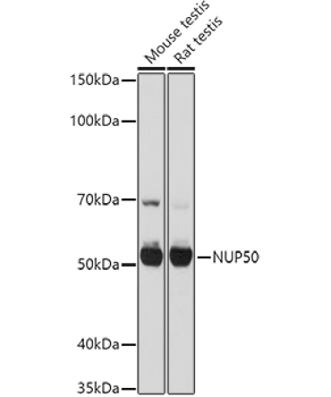 NUP50 Rabbit Polyclonal Antibody