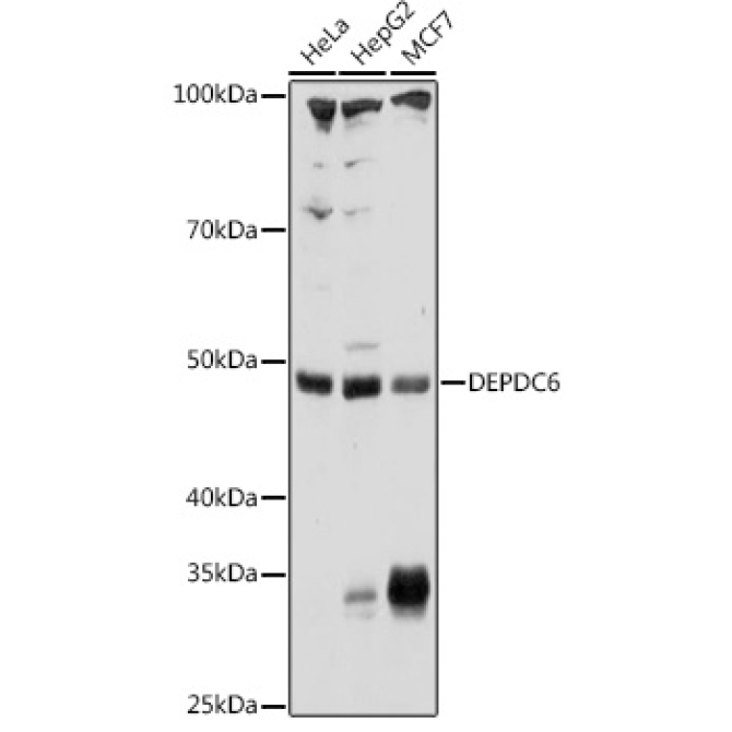 DEPDC6 Rabbit Polyclonal Antibody