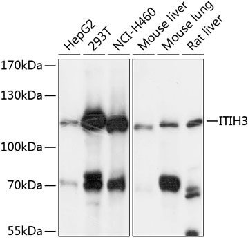ITIH3 Rabbit Polyclonal Antibody