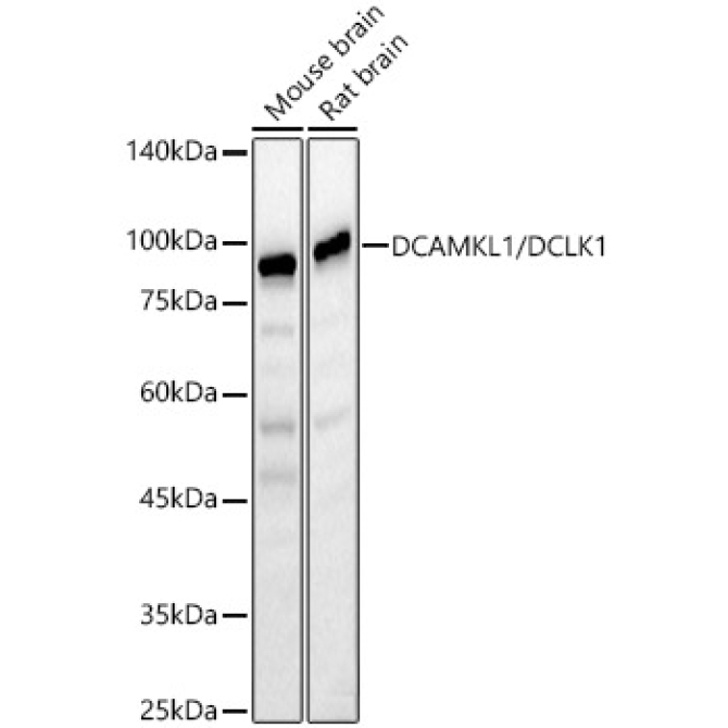 DCAMKL1/DCLK1 Rabbit Polyclonal Antibody