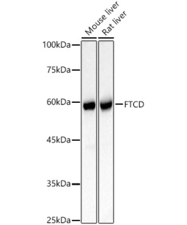 FTCD Rabbit Polyclonal Antibody