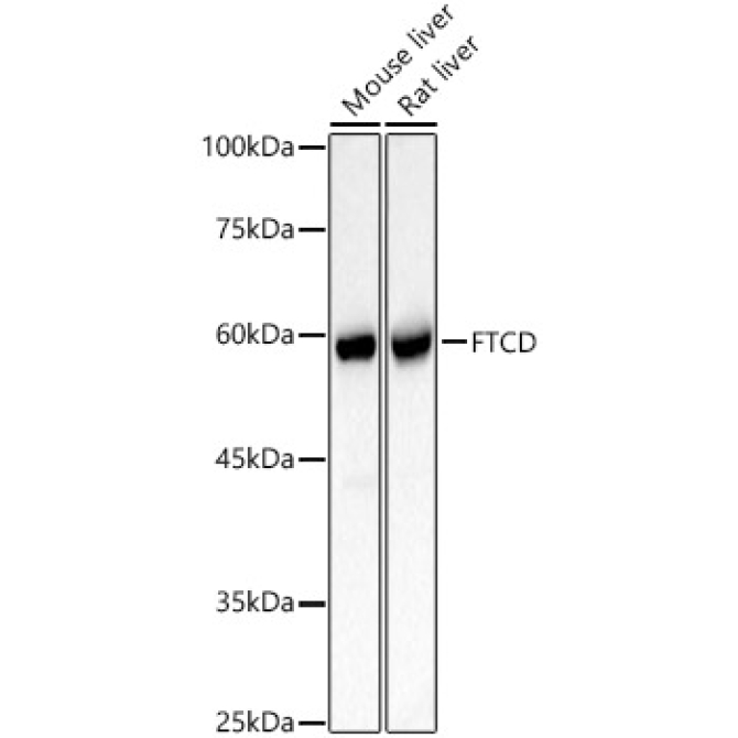 FTCD Rabbit Polyclonal Antibody
