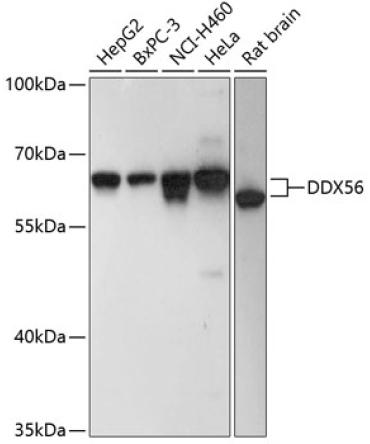 DDX56 Rabbit Polyclonal Antibody