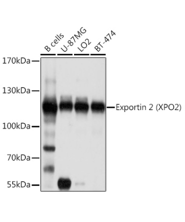 Exportin 2 (XPO2) Rabbit Polyclonal Antibody
