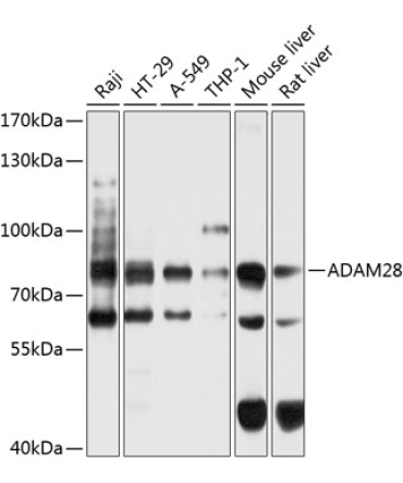 ADAM28 Rabbit Polyclonal Antibody