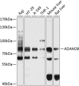 ADAM28 Rabbit Polyclonal Antibody