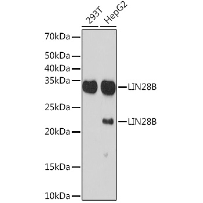 LIN28B Rabbit Monoclonal Antibody
