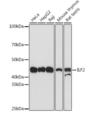ILF2 Rabbit Monoclonal Antibody