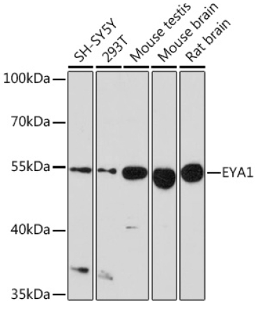 EYA1 Rabbit Polyclonal Antibody