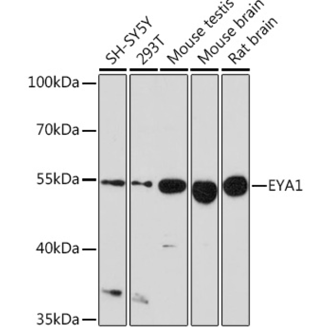 EYA1 Rabbit Polyclonal Antibody