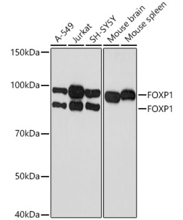 FOXP1 Rabbit Monoclonal Antibody