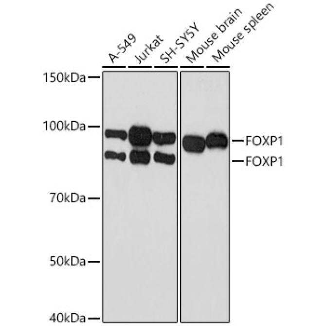 FOXP1 Rabbit Monoclonal Antibody