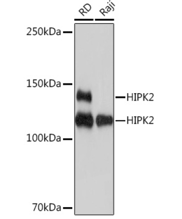 HIPK2 Rabbit Monoclonal Antibody