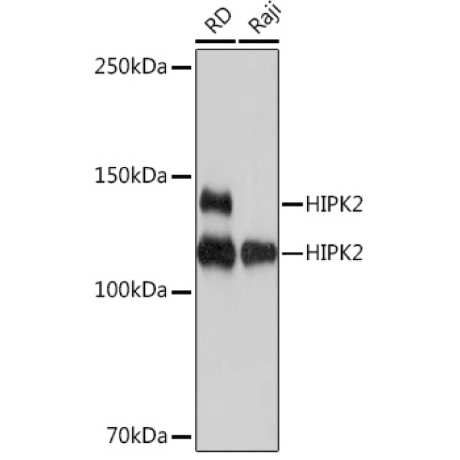 HIPK2 Rabbit Monoclonal Antibody