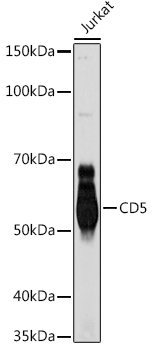 CD5 Rabbit Monoclonal Antibody