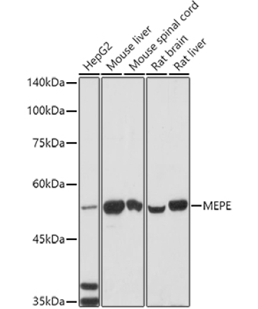 MEPE Rabbit Polyclonal Antibody