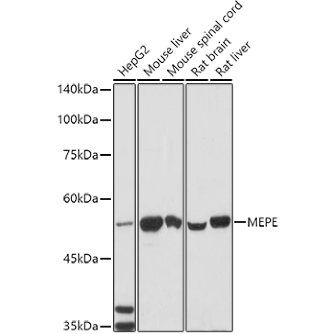 MEPE Rabbit Polyclonal Antibody