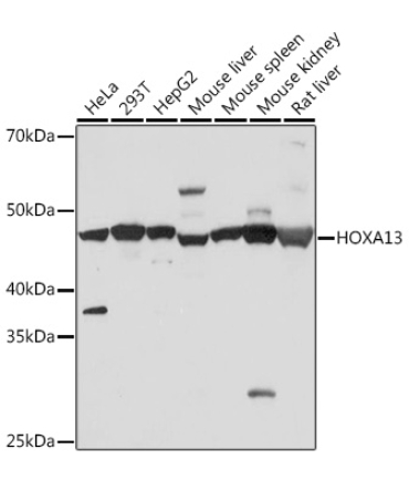HOXA13 Rabbit Monoclonal Antibody