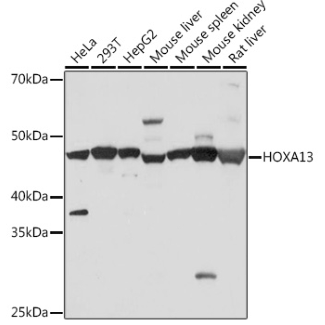 HOXA13 Rabbit Monoclonal Antibody