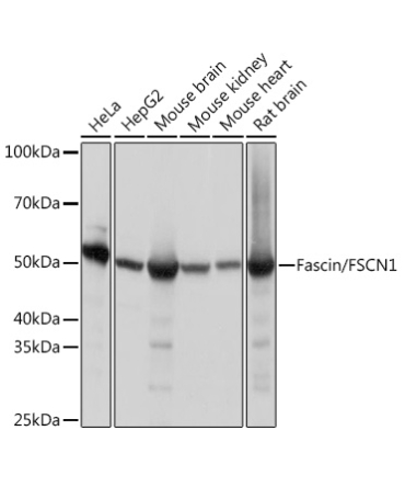 Fascin/FSCN1 Rabbit Monoclonal Antibody
