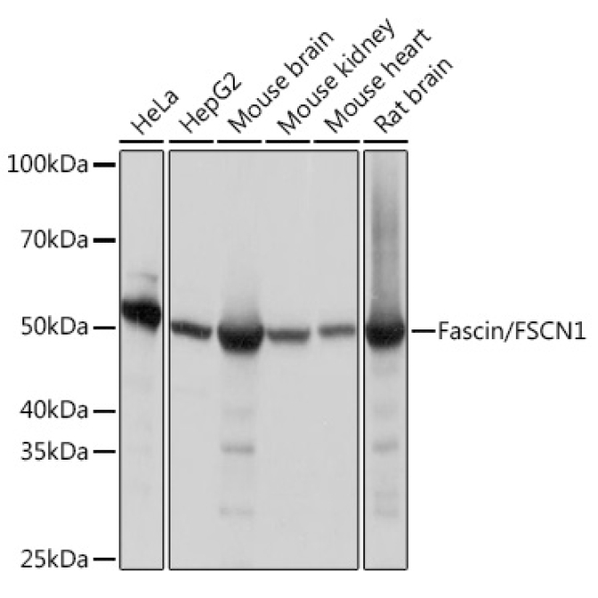 Fascin/FSCN1 Rabbit Monoclonal Antibody