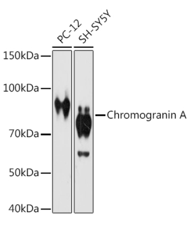 Chromogranin A Rabbit Monoclonal Antibody