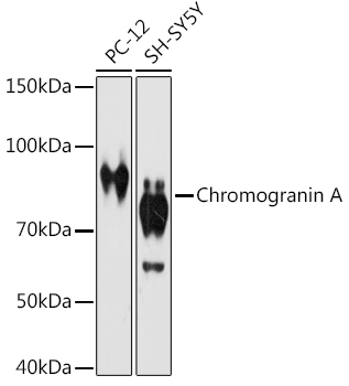 Chromogranin A Rabbit Monoclonal Antibody
