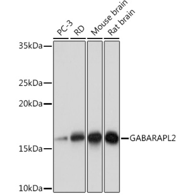 GABARAPL2 Rabbit Monoclonal Antibody