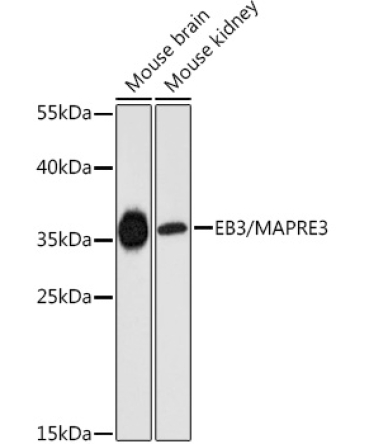 EB3/MAPRE3 Rabbit Polyclonal Antibody