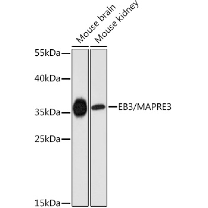 EB3/MAPRE3 Rabbit Polyclonal Antibody