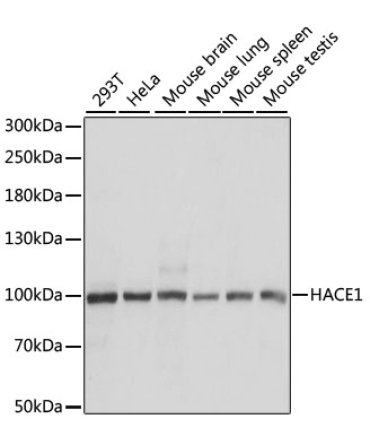 HACE1 Rabbit Polyclonal Antibody