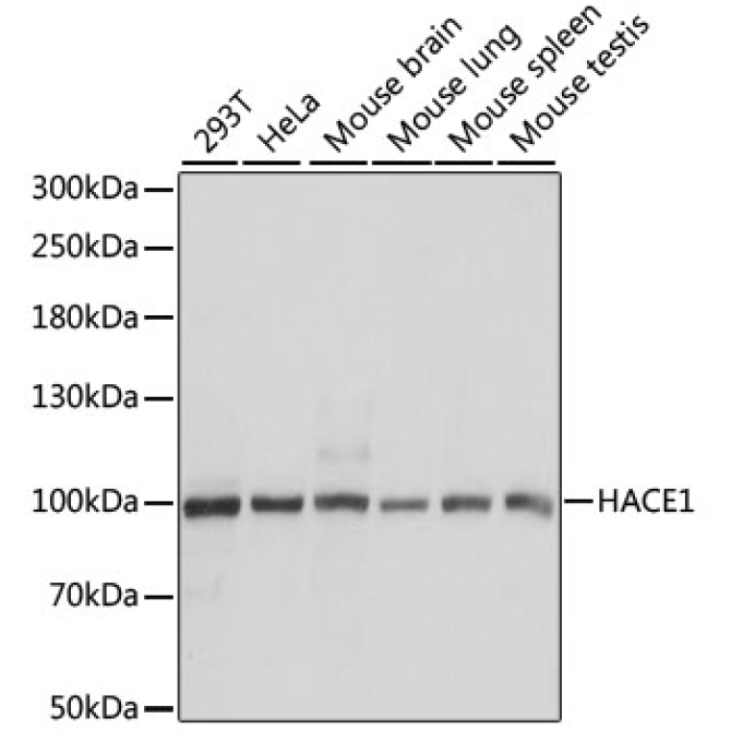 HACE1 Rabbit Polyclonal Antibody