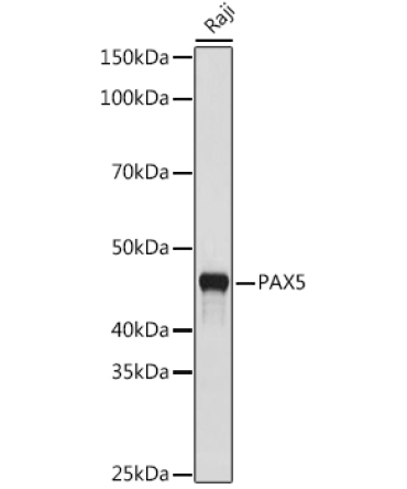 PAX5 Rabbit Monoclonal Antibody