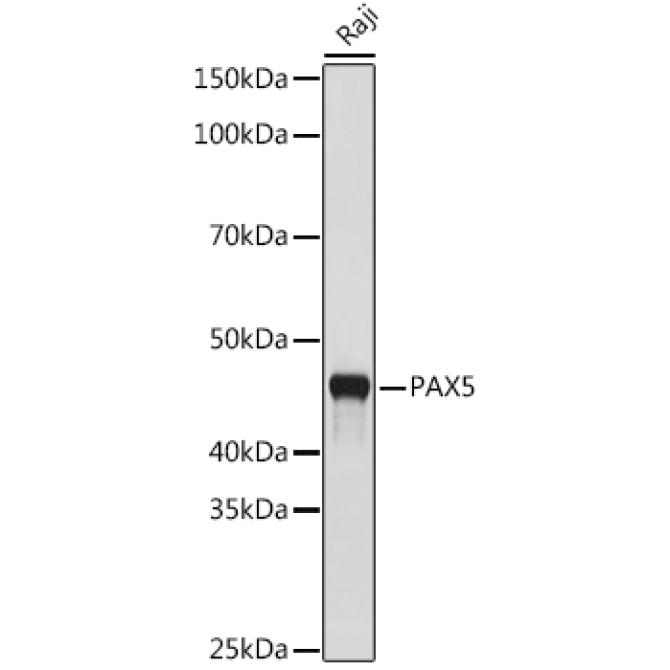 PAX5 Rabbit Monoclonal Antibody