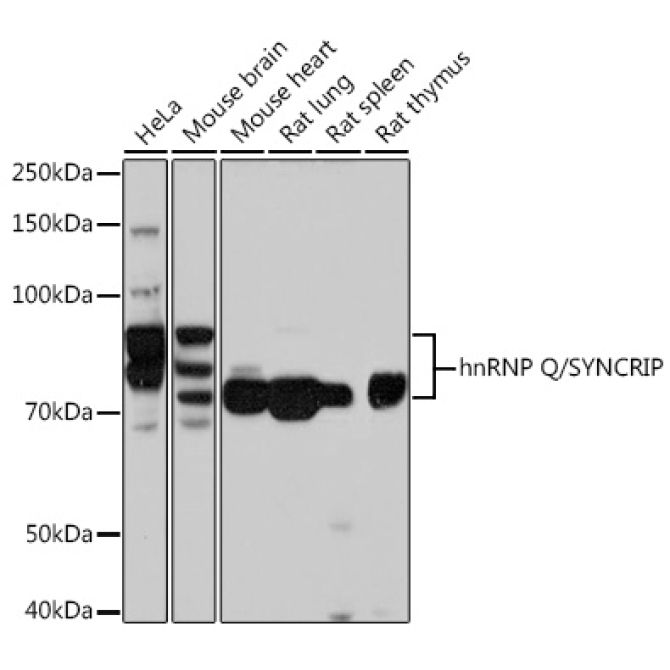hnRNP Q/SYNCRIP Rabbit Monoclonal Antibody