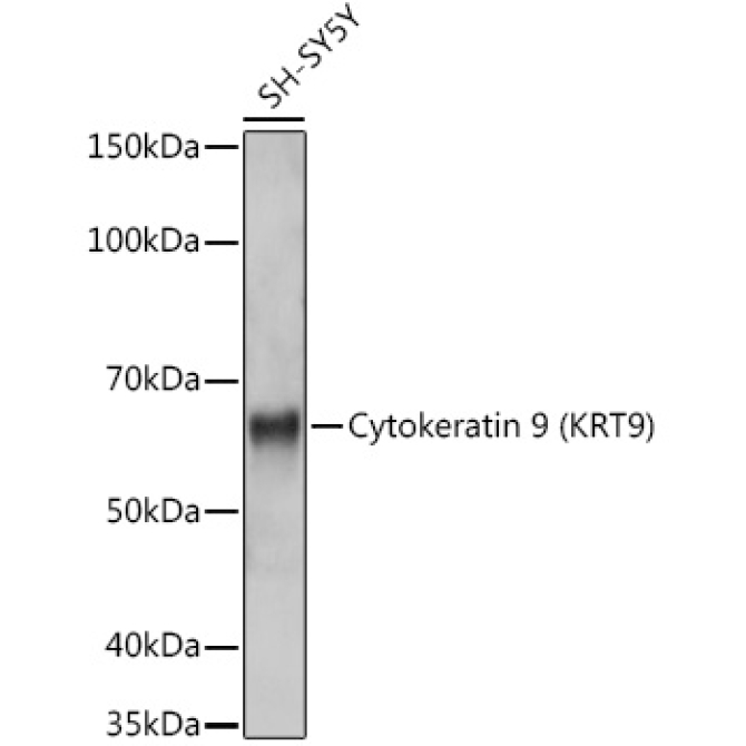 Cytokeratin 9 (KRT9) Rabbit Monoclonal Antibody
