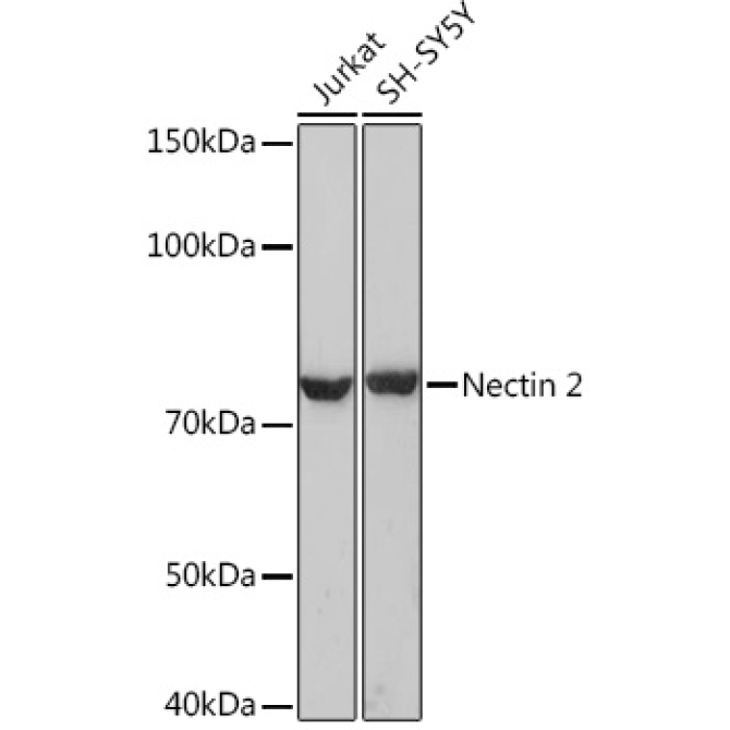 Nectin 2/CD112 Rabbit Monoclonal Antibody