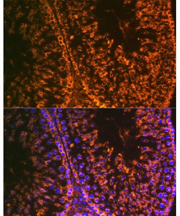 LIN28A Rabbit Monoclonal Antibody