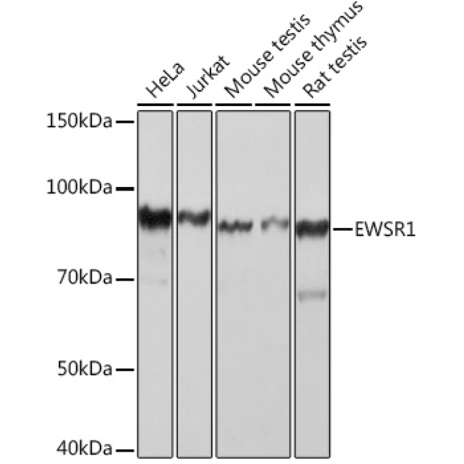 EWSR1 Rabbit Monoclonal Antibody