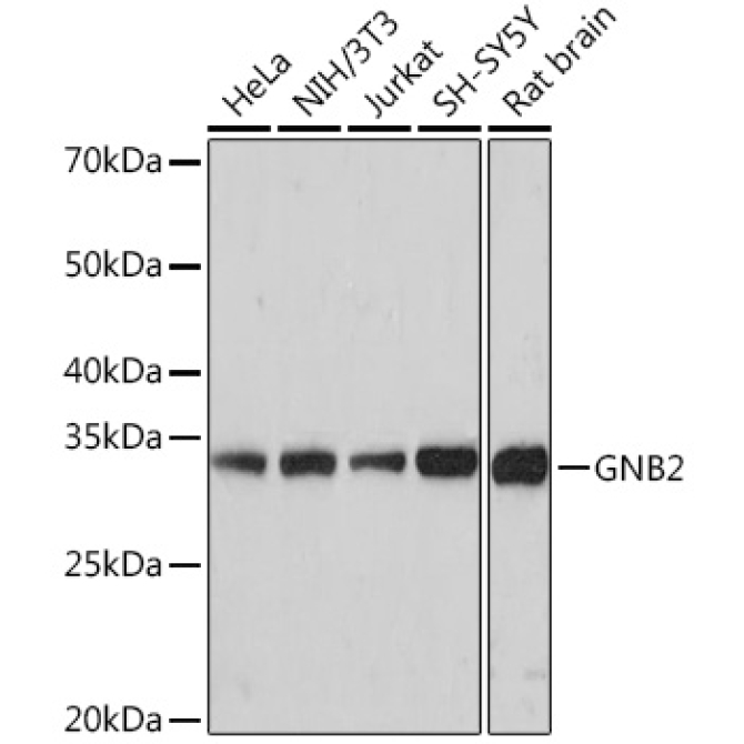 GNB2 Rabbit Monoclonal Antibody