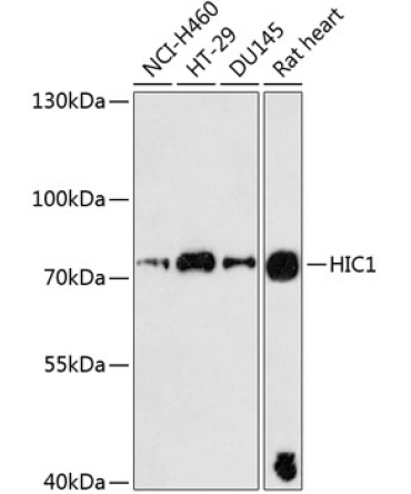HIC1 Rabbit Polyclonal Antibody