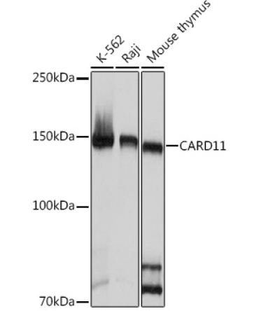 CARD11 Rabbit Monoclonal Antibody