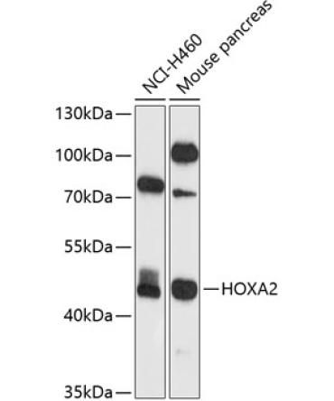 HOXA2 Rabbit Polyclonal Antibody
