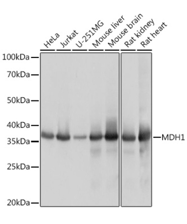 MDH1 Rabbit Monoclonal Antibody