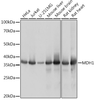 MDH1 Rabbit Monoclonal Antibody