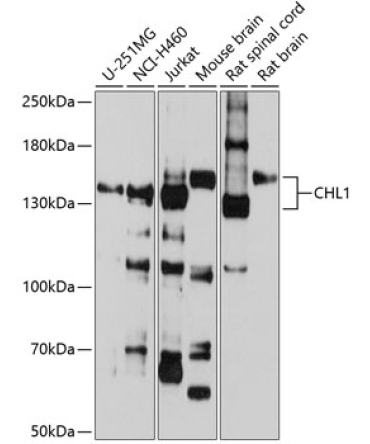 CHL1 Rabbit Polyclonal Antibody