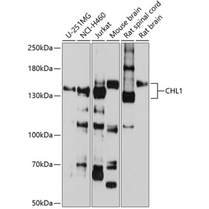 CHL1 Rabbit Polyclonal Antibody