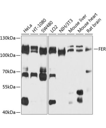 FER Rabbit Polyclonal Antibody