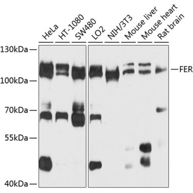 FER Rabbit Polyclonal Antibody